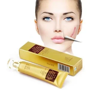 Crème Anti vergetures-cicatrices & Acné